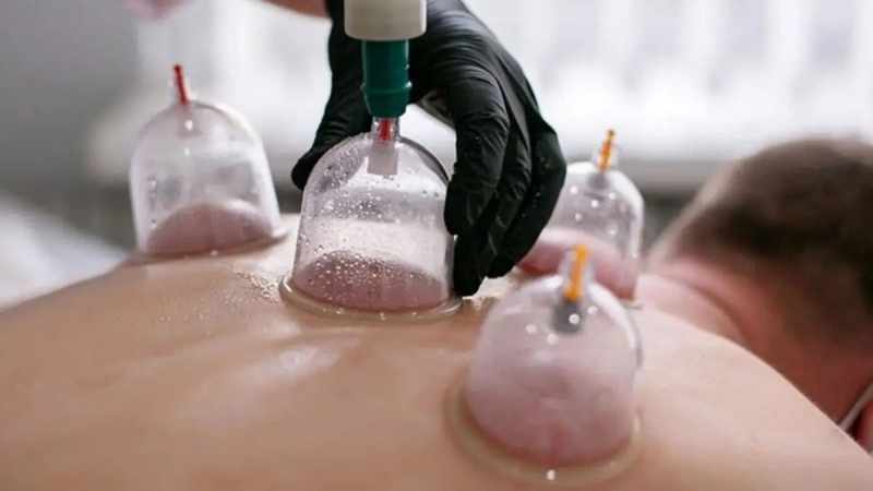 Hacamat Uygulaması, Doktor Denetimi ve Steril Ortamda Gerçekleştirilmeli